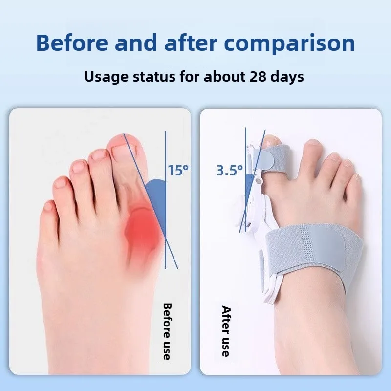 Soporte de Pies Ergonómico Ajustable - Pack para Ambos Pies - Imagen 2